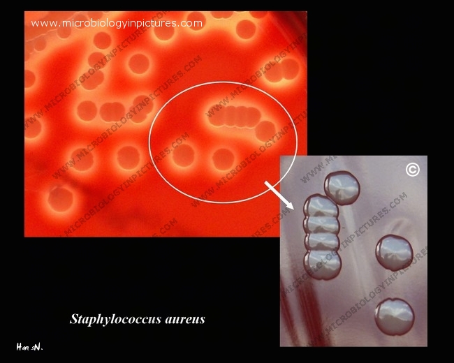 s.aureus beta-hemolysis